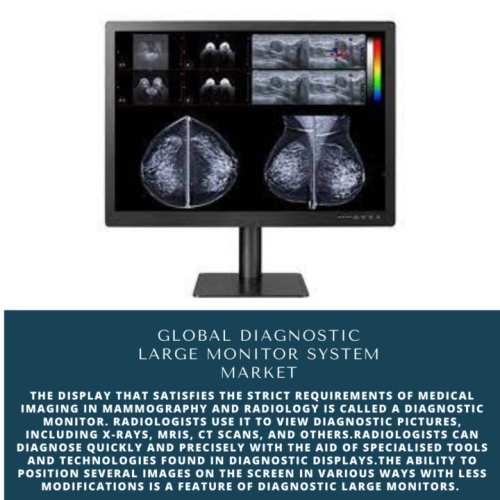 Infographics-Diagnostic Large Monitor System Market, Diagnostic Large Monitor System Market Size, Diagnostic Large Monitor System Market Trends, Diagnostic Large Monitor System Market Forecast, Diagnostic Large Monitor System Market Risks, Diagnostic Large Monitor System Market Report, Diagnostic Large Monitor System Market Share